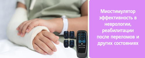 Миостимулятор с тремя режимами (EMS, TENS, комбинированный): эффективность в неврологии, реабилитации после переломов и других состояниях